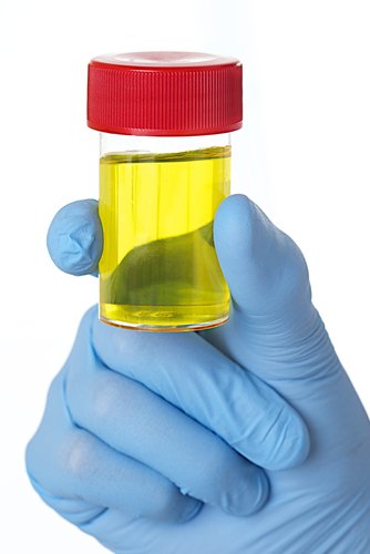 Gejala dan Cara Mengobati Infeksi Saluran Kemih