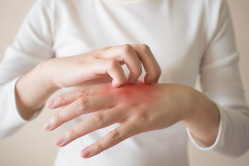 5 Bahan Alami untuk Obat Gatal Kulit Gejala Ringan 