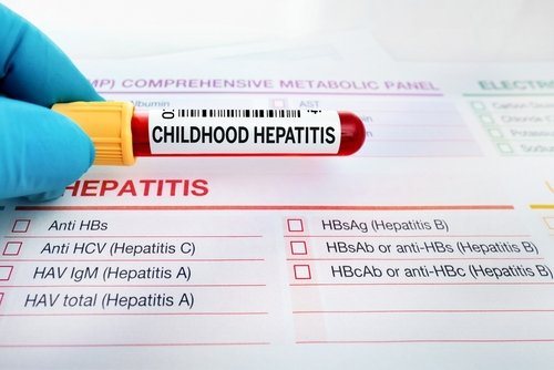 5 Gejala Hepatitis Akut yang Perlu Anda Waspadai